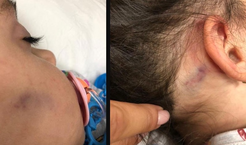 Anaokulunda akıl almaz şiddet!