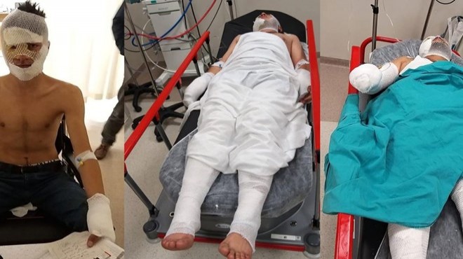 Acemi kundakçılar kendilerini yaktı