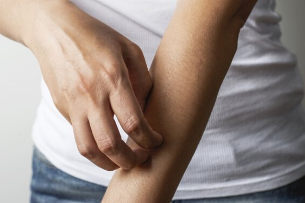 Sağlık Bakanlığı'ndan uyuz uyarısı