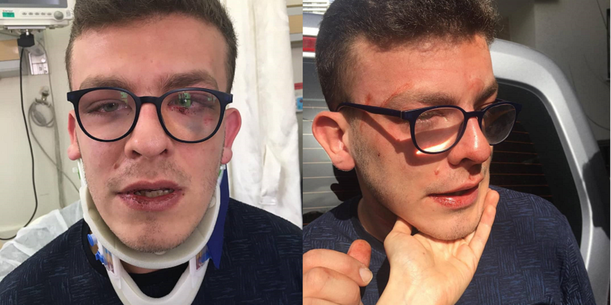 Otizmli genci öldüresiye dövdüler! “Döverken ben engelliyim dedim”