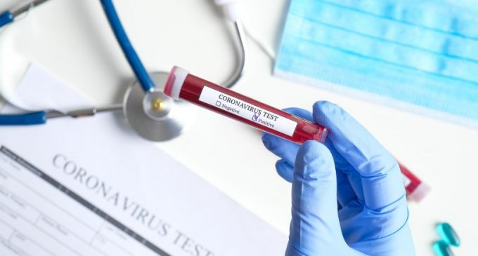 Koronavirüs testi yaptırmak ücretli mi?