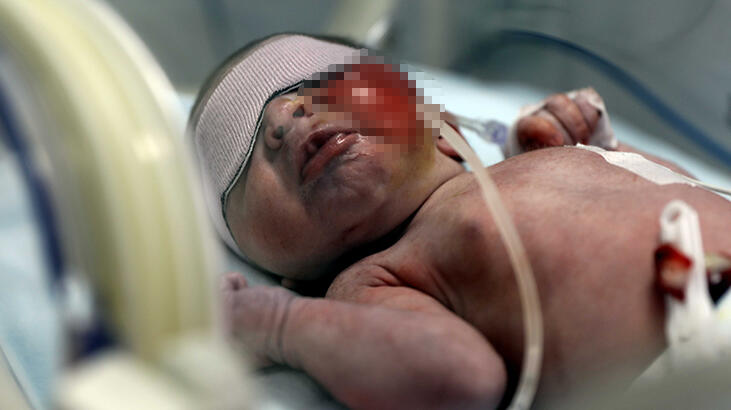 Yürek yakan olay! Çöpte yeni doğmuş bebek bulundu