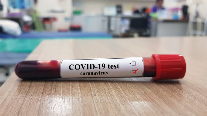 Bakan açıkladı: Korona'ya karşı yerli ilacı ürettik