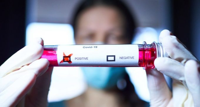 Dünya genelinde koronavirüs vaka sayısı 22 milyonu aştı