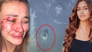 Çeşme'de dövüldüğünü öne süren Ukraynalı modelin soruşturmasında yeni adli tıp raporları