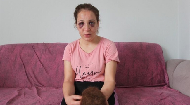 Aydın'da vahşet! 3 çocuk annesi kadını, kocası bu hale getirdi