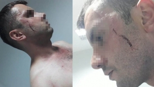 Hasta yakınları personeli darp etti