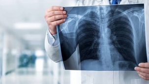 Röntgen filmlerinden koronavirüsü teşhis eden sistem geliştirildi