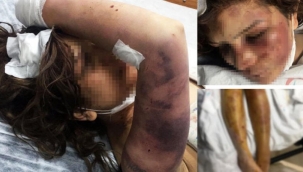 Suriyeli Mirvet yaşadığı dehşeti anlattı... 