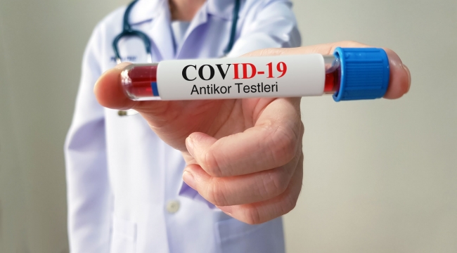 Uzak Doğu'dan ithal edilen antikor test kitlerindeki tehlike!