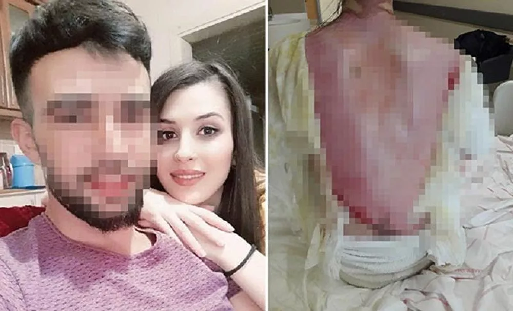 Eşi ve 1.5 yaşındaki kızının üzerine kaynar su döken kişi: Kazara oldu 