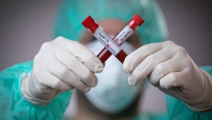 Dünyada ilk kez sadece Türkiye’de üretilecek: ASC zerrecik aşısı 