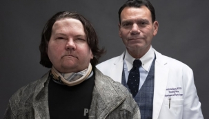 Dünyanın ilk eş zamanlı çift el ve yüz nakli yapıldı!