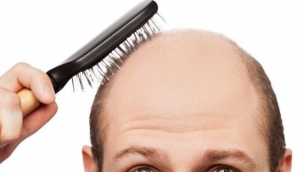 Japon bilim insanları kelliğe çare buldu!