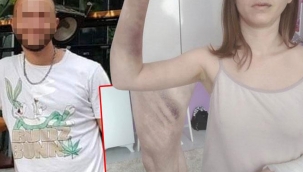 İzmir'de kadına şiddet: Beyzbol sopasıyla saldırdı!