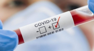 Aşısız gençlerde vaka artışı!