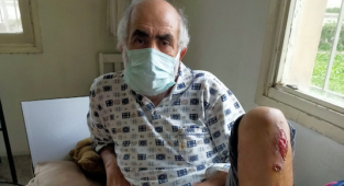 Bacağı kesilen palet ustası yardım bekliyor