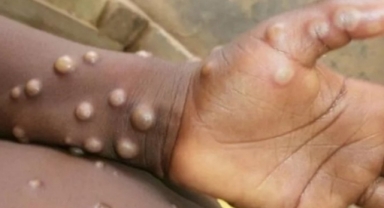 Bakan Koca'dan Maymun Çiçeği açıklaması