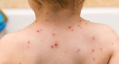 İzmir Tabip Odası: 