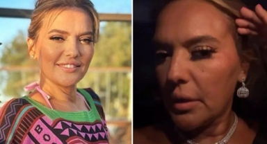 Demet Akalın tekne kazası geçirdi: 