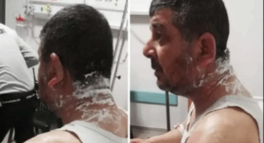 Meclis üyesi adayına asitli saldırı: 