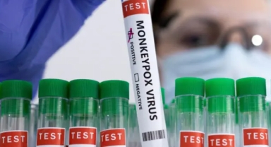 Maymun Çiçeği Hastalığı Yeni Bir Salgın Tehdidi mi?