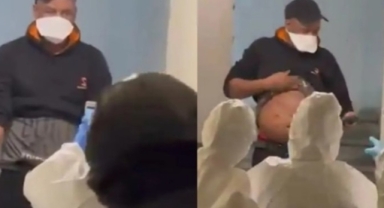 İstanbul'da Maymun Çiçeği paniği: Resmi açıklama geldi