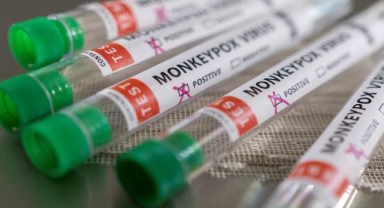 Maymun Çiçeği virüsüne karşı ilk aşı onay aldı!