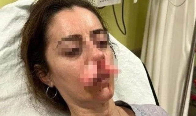 Kocasının sevgilisi sanıp saldırdı: Otomobil kapısı silah sayıldı!