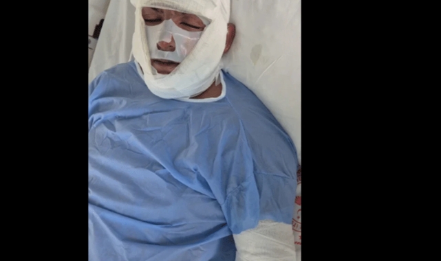 İki gencin çakmaz gazı deneyimi faciayla sonlandı!