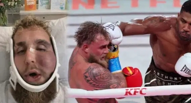 Yüzü tanınmaz hale gelmişti: Kazandığı para dudak uçuklattı!